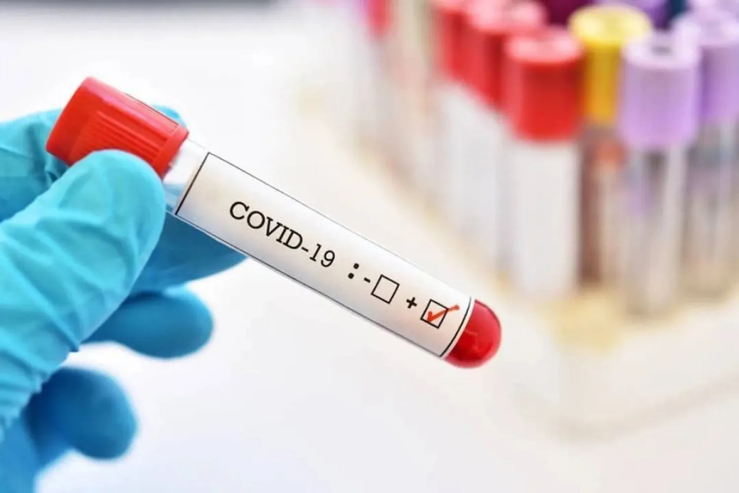 В Казахстане за сутки зарегистрировали 4320 случаев заражения Covid-19