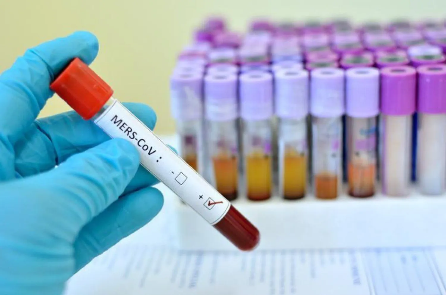 С чем связано увеличение числа бессимптомных носителей Covid-19, ответили в акимате