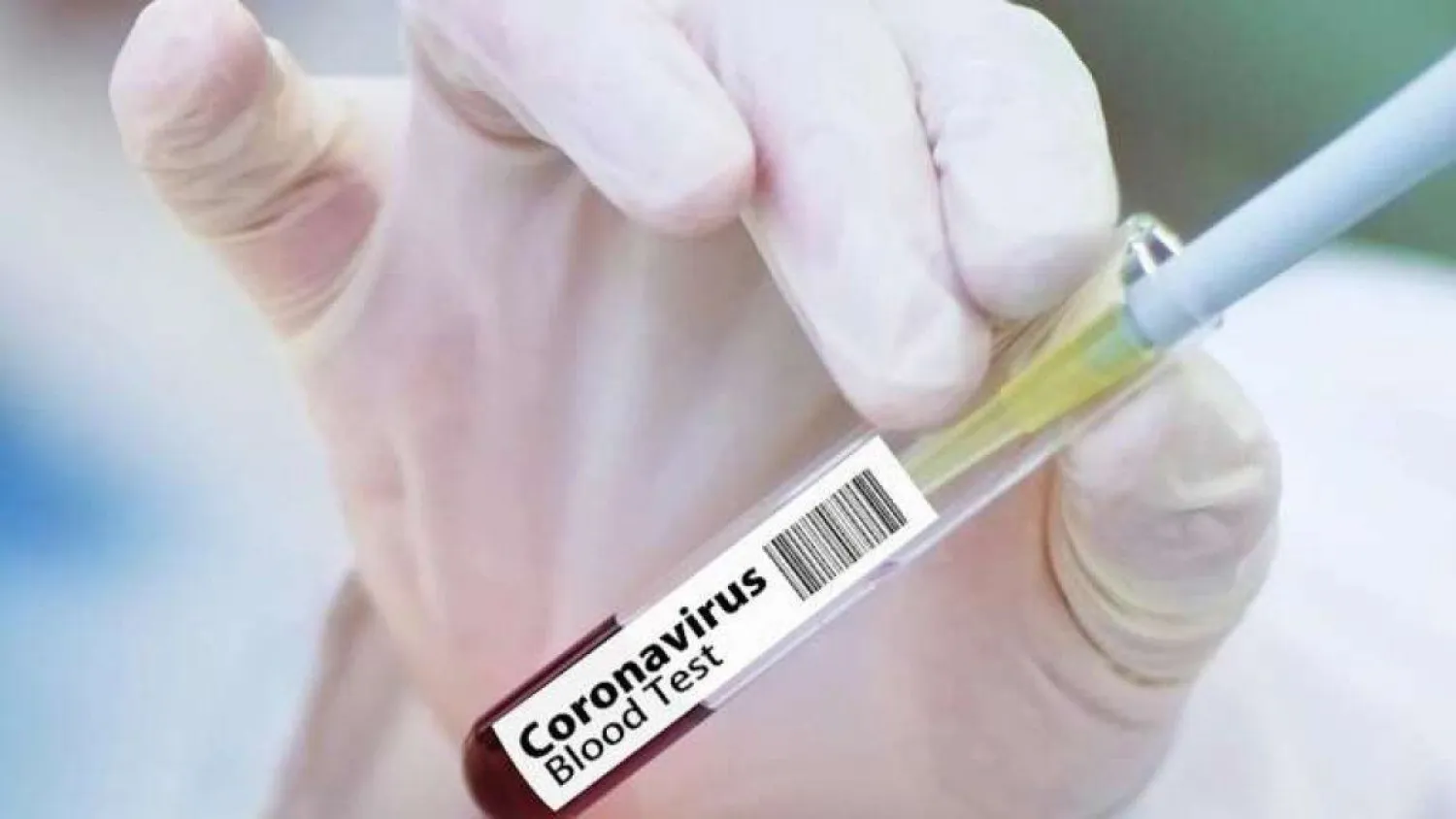 В Казахстане провели более 1 млн тестов на COVID-19