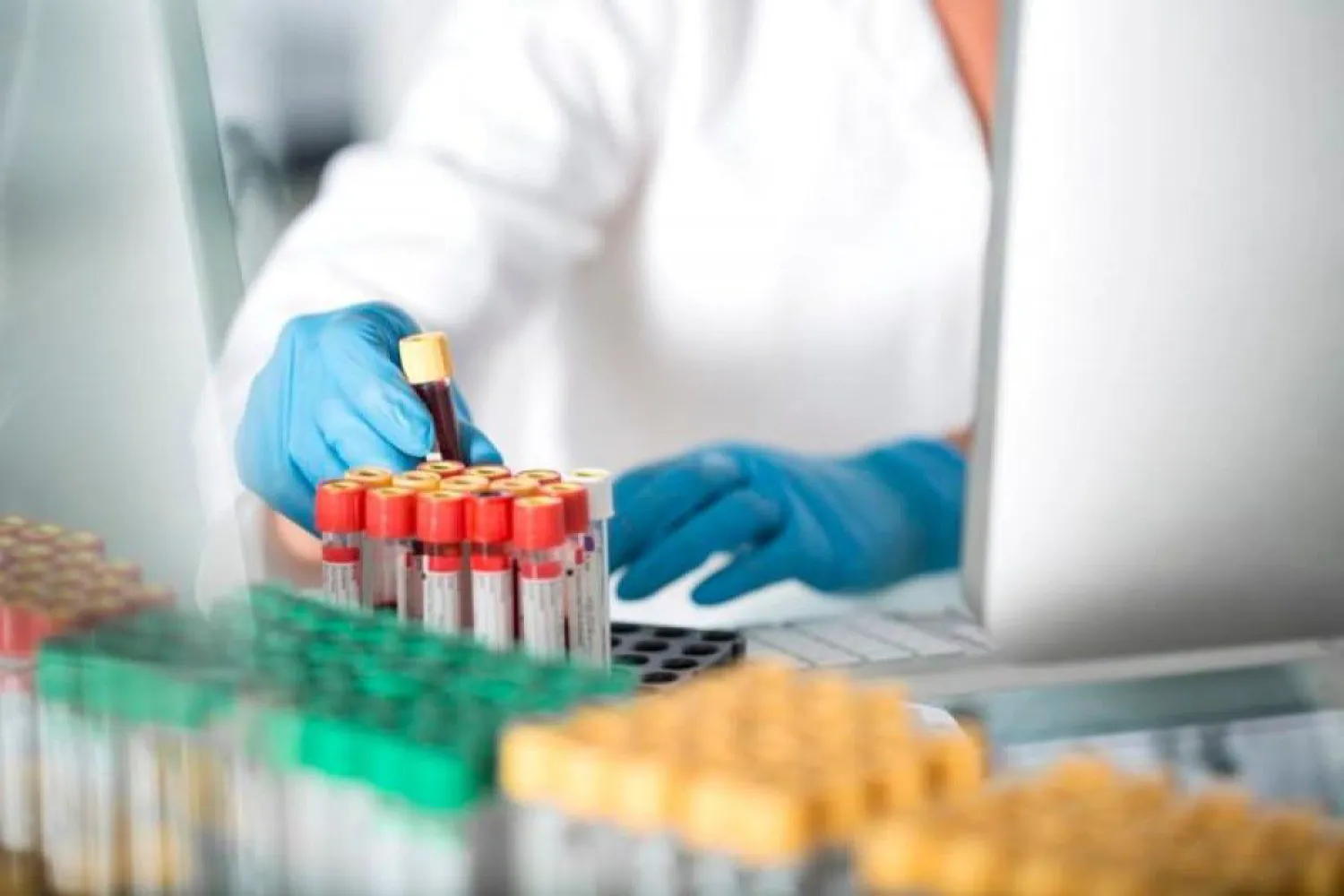 В столице проведено свыше 148 тыс тестов на КВИ