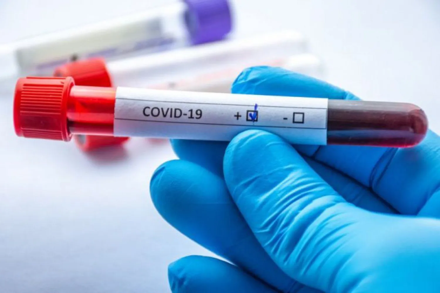 260 новых случаев COVID-19 выявлены в РК за сутки