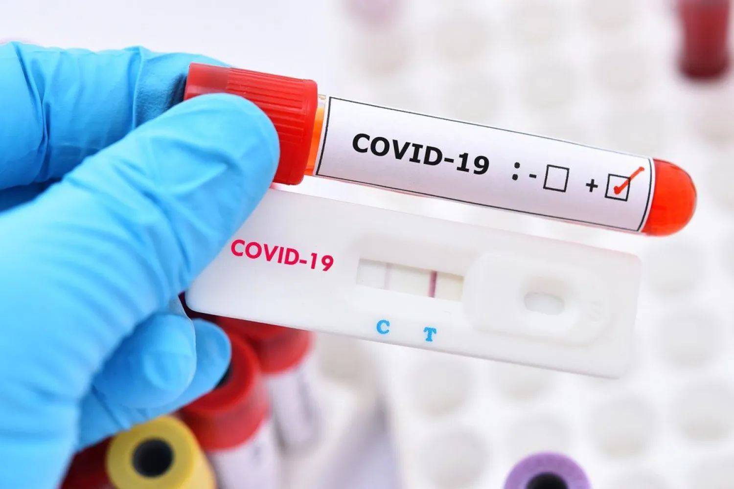 В Казахстане зарегистрировано более 9 тысяч новых случаев COVID-19
