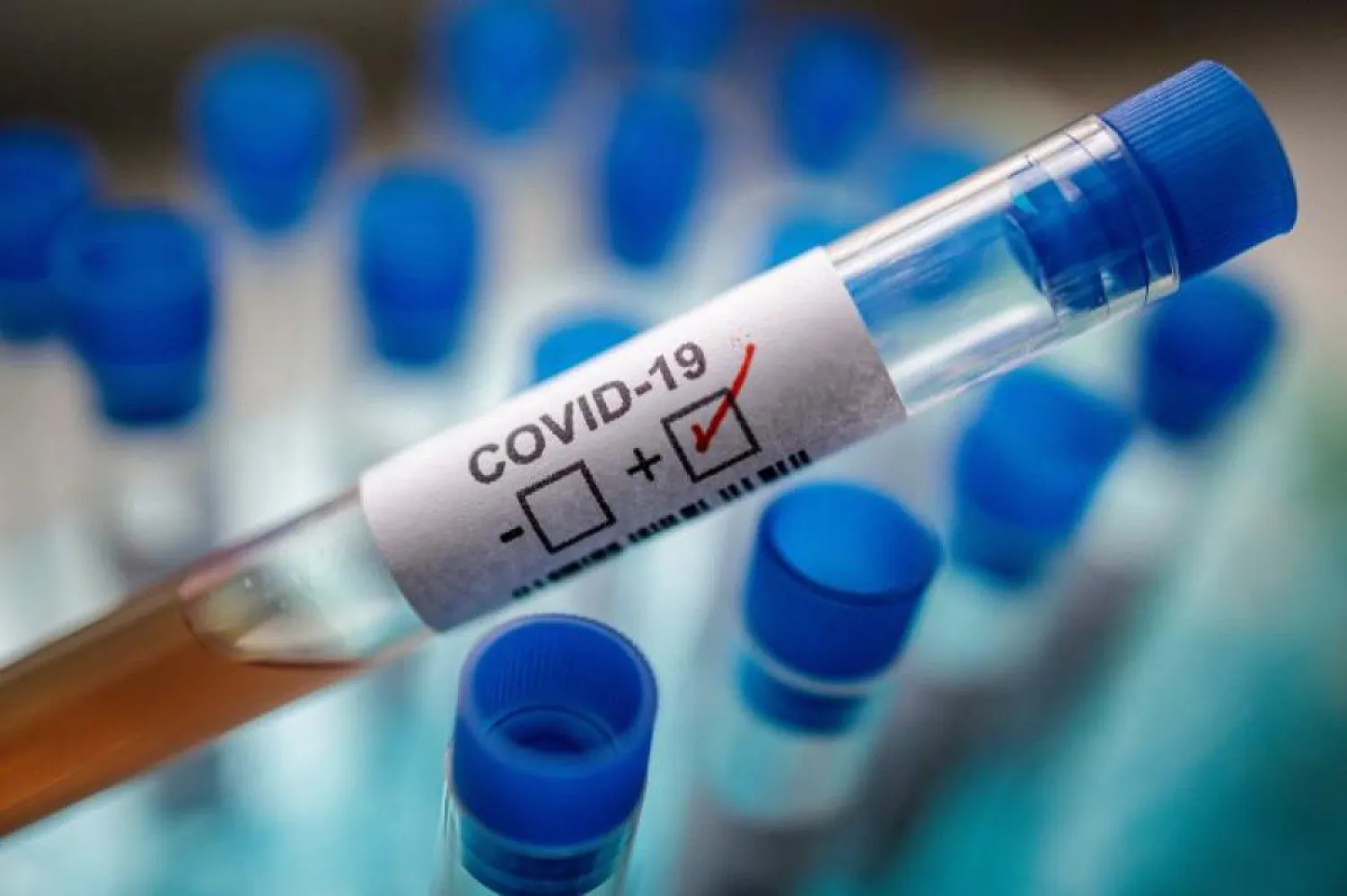С начала пандемии выявлено более 890 тыс случаев COVID-19 в Казахстане