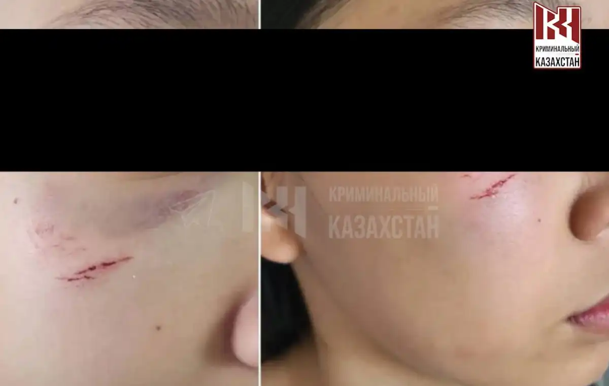 В Астане неизвестный напал на двух несовершеннолетних девочек