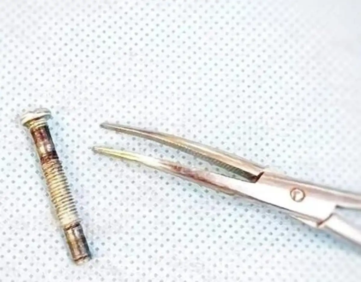 Годовалый ребенок проглотил болт в Туркестанской области