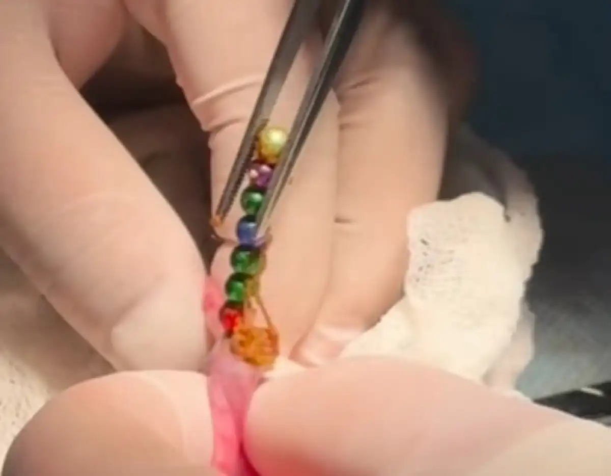 3-летний ребенок проглотил 16 магнитов в Шымкенте (ВИДЕО)