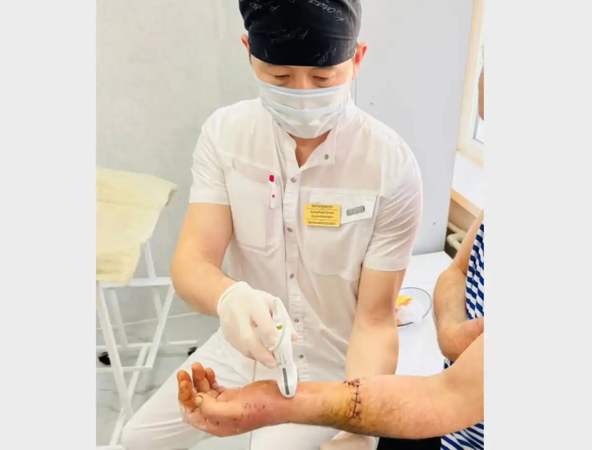 Отрезанную болгаркой руку пришили 60-летнему шымкентцу