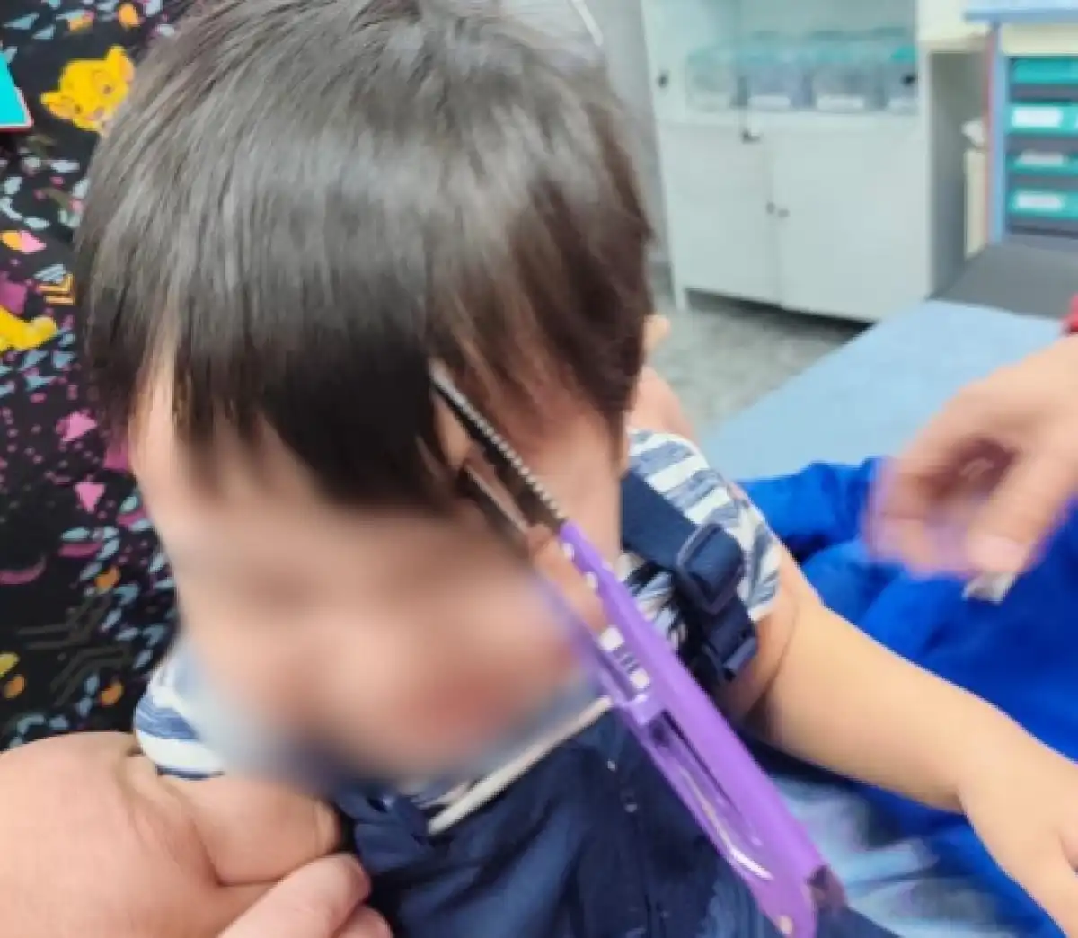 Ножницы извлекли из головы 2-летнего ребенка в Алматы